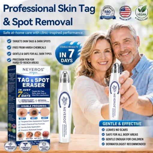 NEYEROS®✨ 𝟕-𝐃𝒂𝘆 𝐒𝗸𝐢𝐧 𝐓𝒂𝗴 & 𝐒𝐩𝙤𝐭 𝐄𝐫𝒂𝐬𝙚𝐫 𝐏𝐚𝐢𝐧𝐥𝐞𝐬𝐬 & 𝐒𝐜𝐚𝐫-𝐅𝐫𝐞𝐞 𝐀𝐝𝐯𝐚𝐧𝐜𝐞𝐝 𝐈𝐦𝐩𝐞𝐫𝐟𝐞𝐜𝐭𝐢𝐨𝐧 𝐑𝐞𝐦𝐨𝐯𝐚𝐥 𝐑𝐨𝐥𝐥𝐞𝐫𝐛𝐚𝐥𝐥 𝐏𝐞𝐧