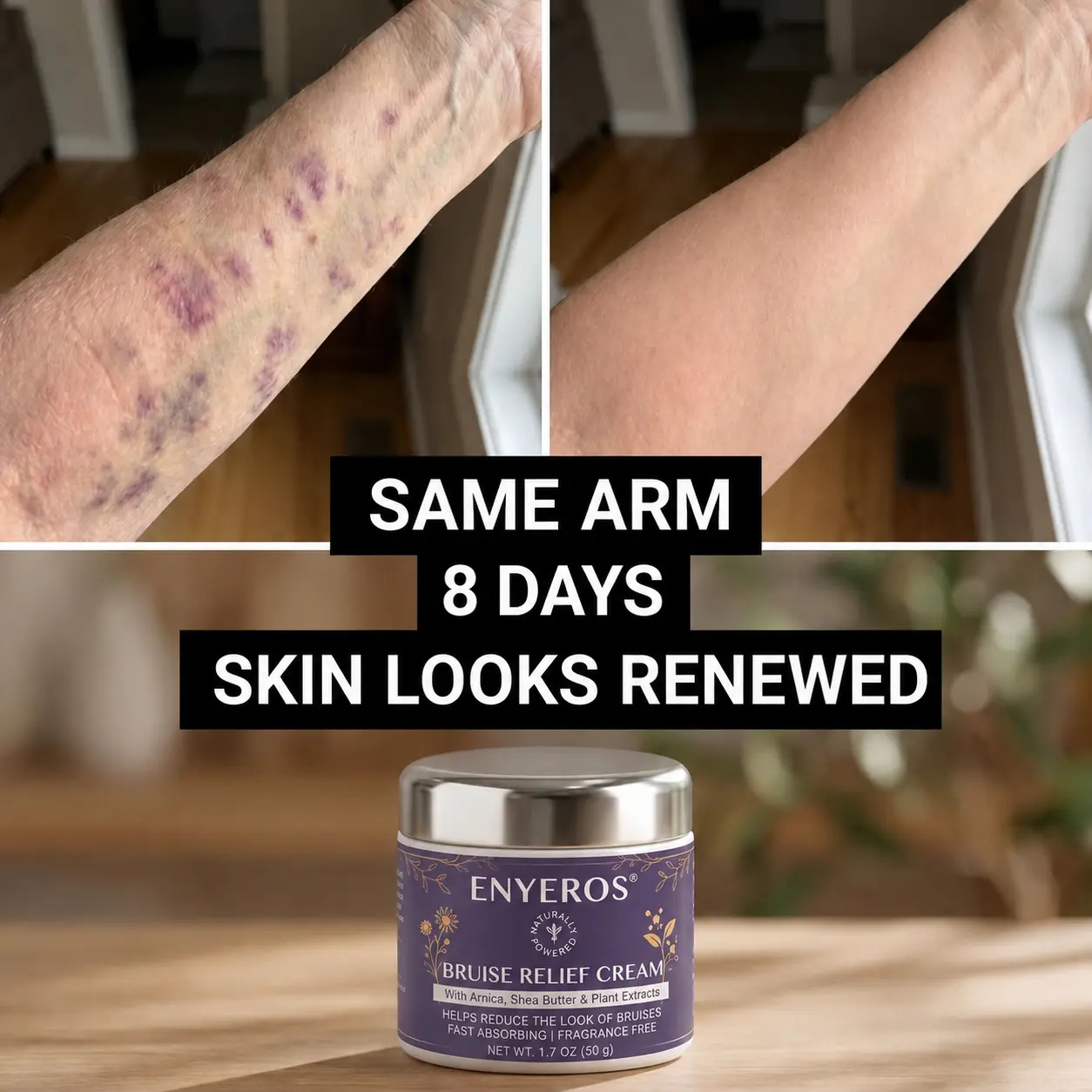 NEYEROS® Bruise Relief & Skin-Strengthening Cream