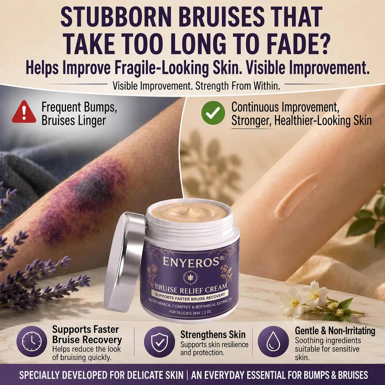 NEYEROS® Bruise Relief & Skin-Strengthening Cream