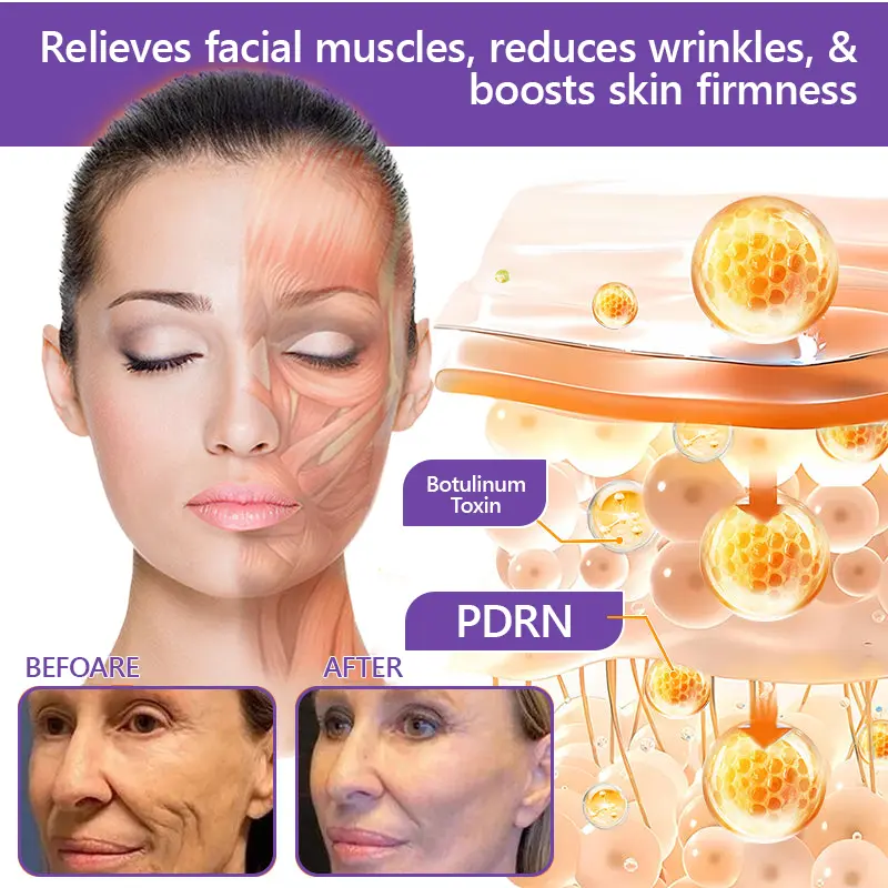 ๐ต๐๐๐๐๐๐ยฎ PDRN Multi-Peptide Massaging Body Roller Cream
