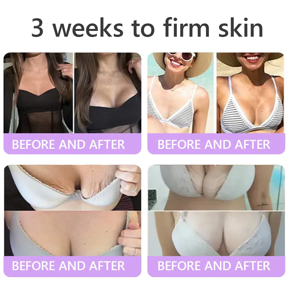 ๐ต๐๐๐๐๐๐ยฎ PDRN Multi-Peptide Massaging Body Roller Cream