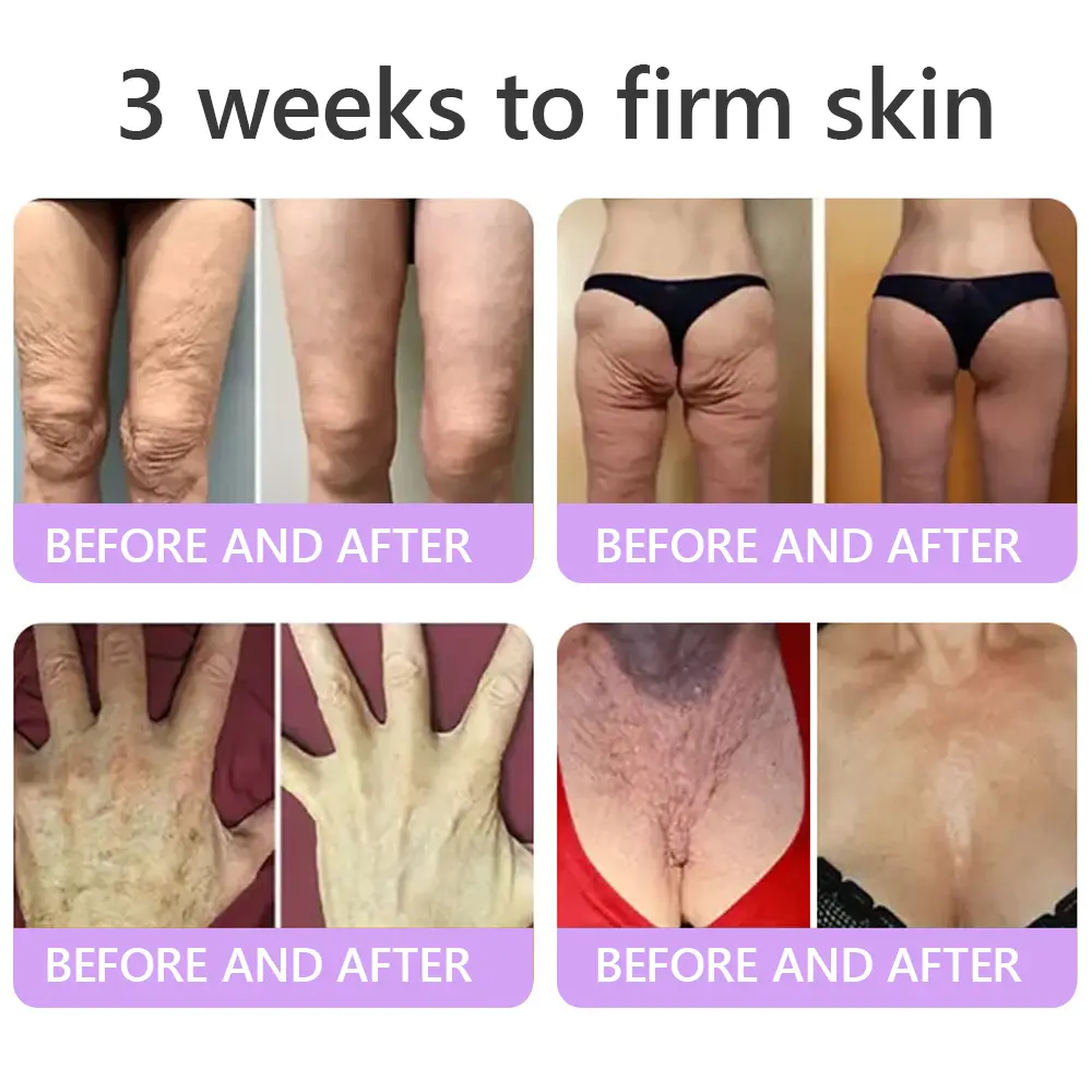 ๐ต๐๐๐๐๐๐ยฎ PDRN Multi-Peptide Massaging Body Roller Cream