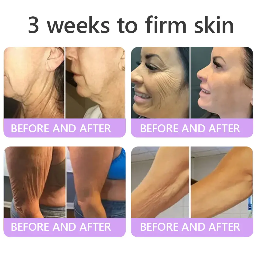 ๐ต๐๐๐๐๐๐ยฎ PDRN Multi-Peptide Massaging Body Roller Cream