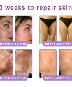 ๐ต๐๐๐๐๐๐ยฎ PDRN Multi-Peptide Massaging Body Roller Cream
