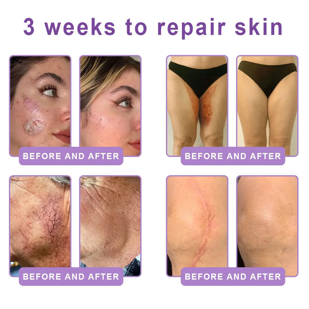 ๐ต๐๐๐๐๐๐ยฎ PDRN Multi-Peptide Massaging Body Roller Cream