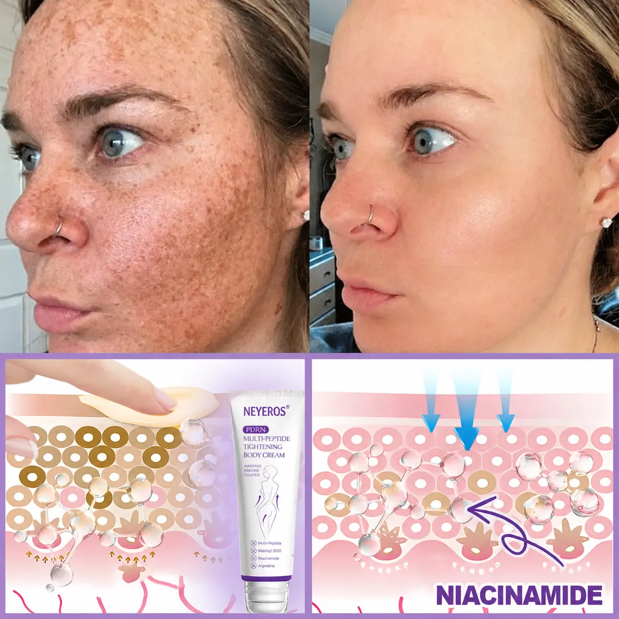 ๐ต๐๐๐๐๐๐ยฎ PDRN Multi-Peptide Massaging Body Roller Cream