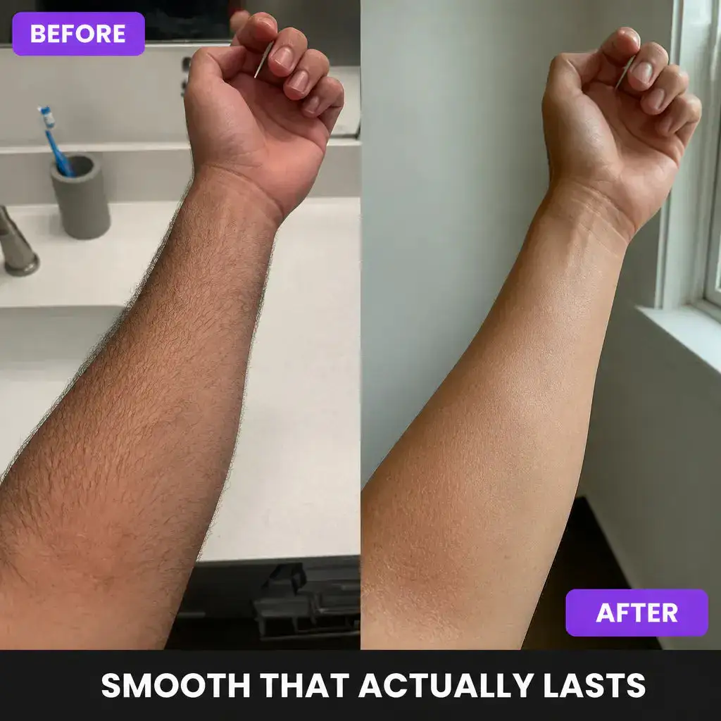 NEYEROS Men Premium Hair Removal Spray