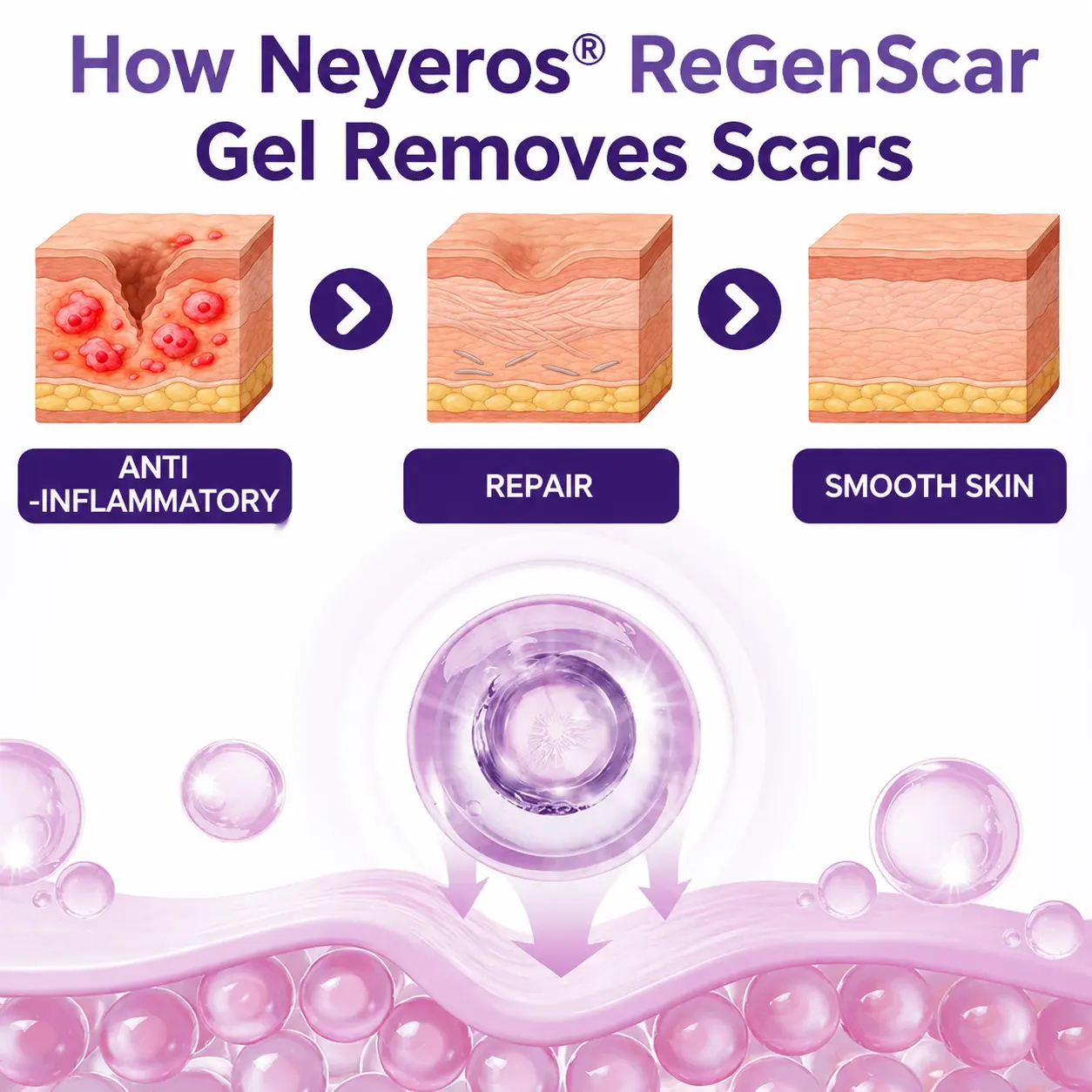 Neyeros® ReGenScar Stem Cell Scar Gel